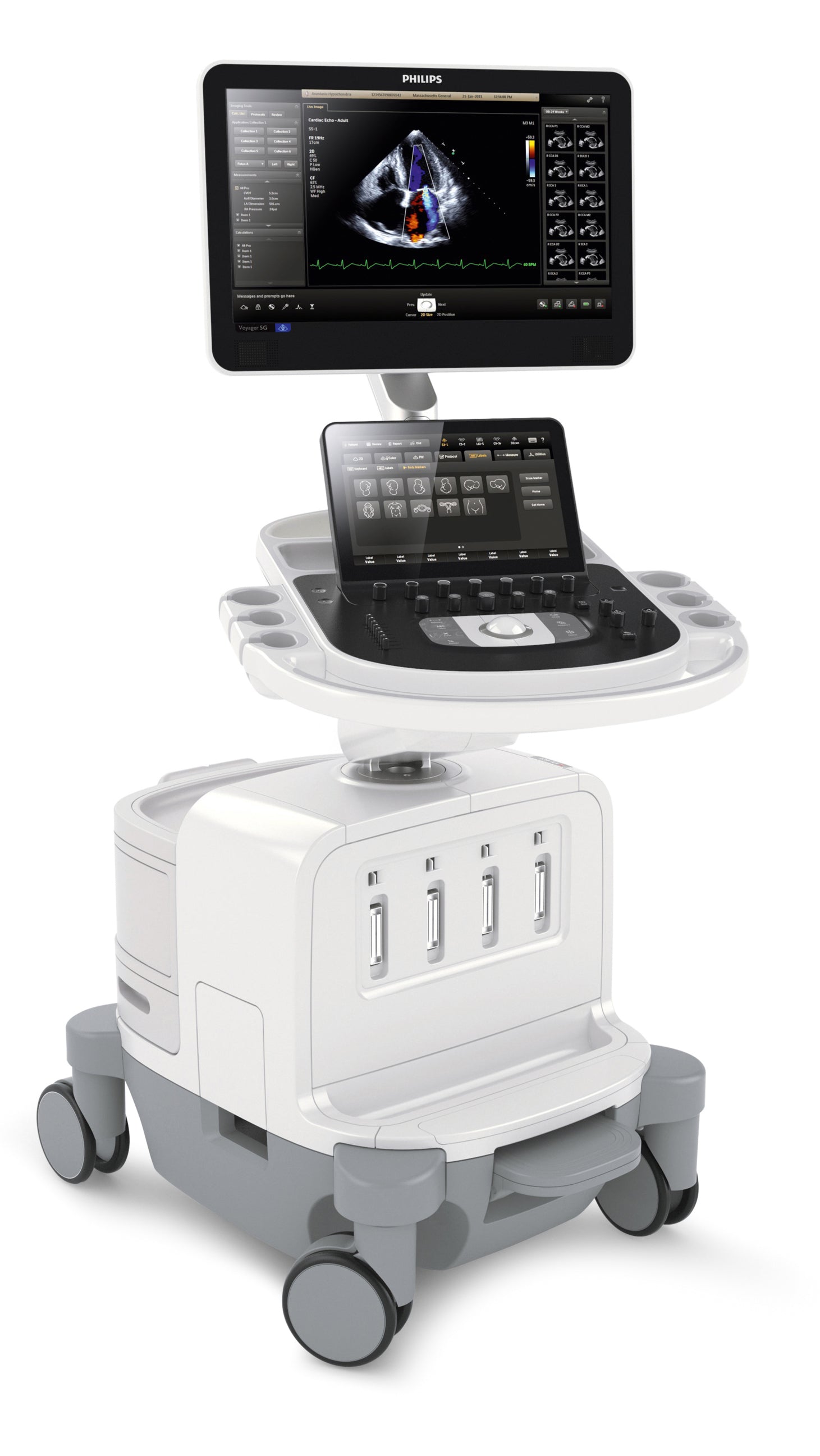 Philips EPIQ 5